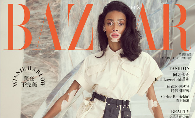 Winnie Harlow