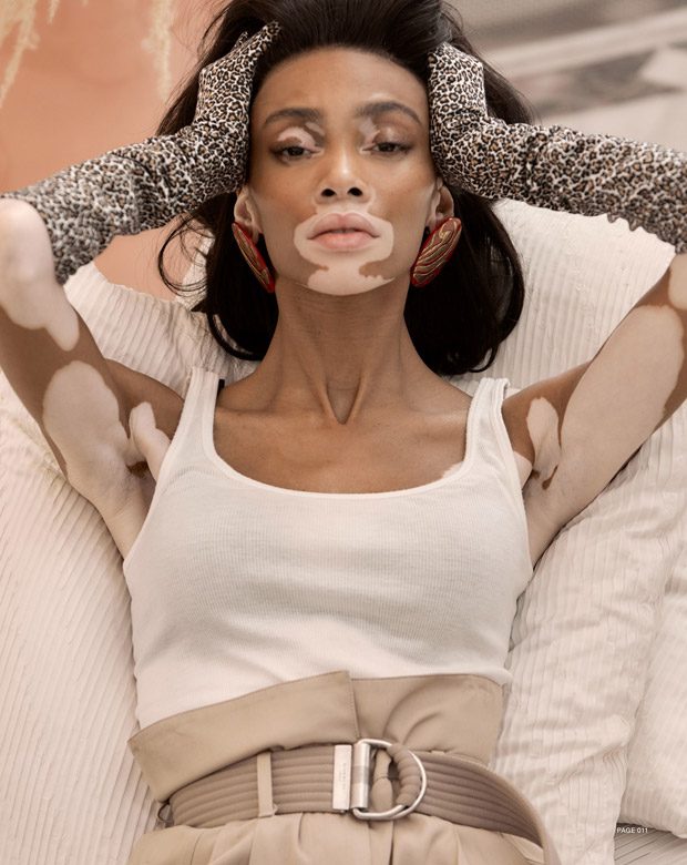 Winnie Harlow