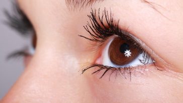 What to Expect from LASIK Surgery
