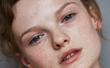 Skin Care Tips to Follow After a Cosmetic Procedure