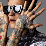 Tattoo Removal London